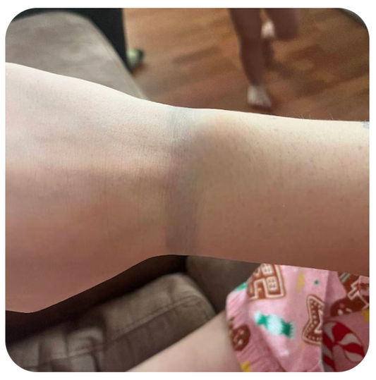 Why does my skin turn green after wearing silver?